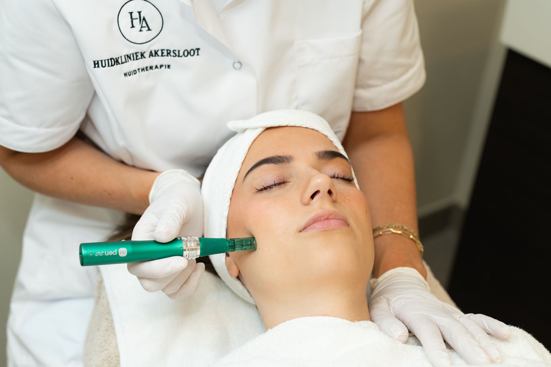 Microneedling behandeling bij Huidkliniek Akersloot